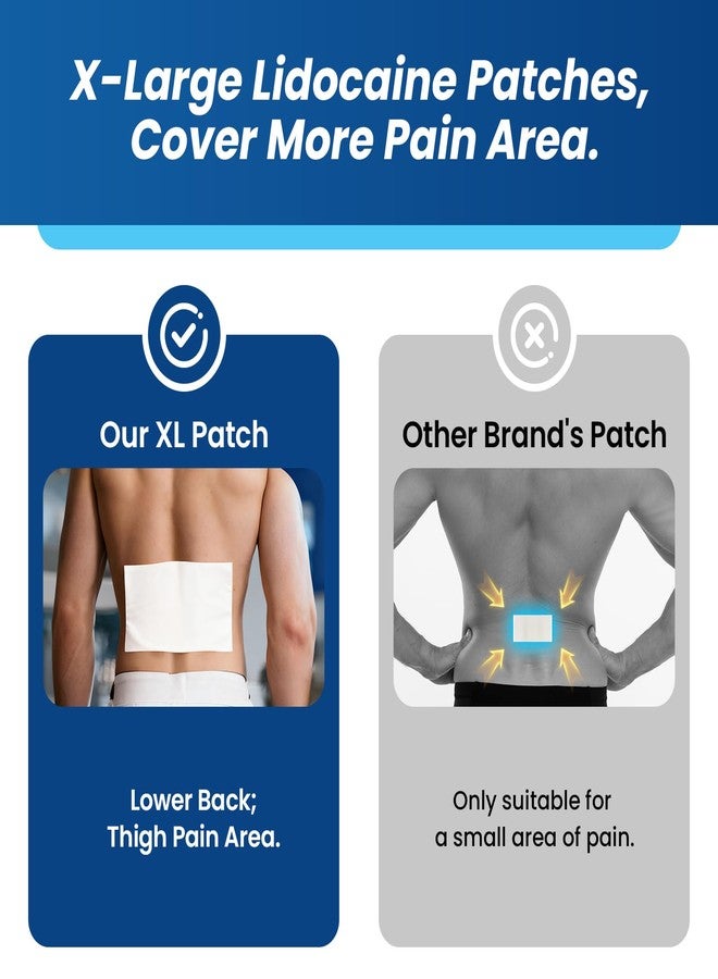 سوميفون لصقات سوميفن إكس إل ليدوكايين 4%، أقصى قوة تخدير بدون وصفة طبية، لصقات كبيرة جدًا 4.72 بوصة × 7.87 بوصة لتسكين آلام الظهر والساق بالكامل، تسكين طويل الأمد للألم لمدة 8 ساعات (كبيرة جدًا، العدد 16) - Image 4